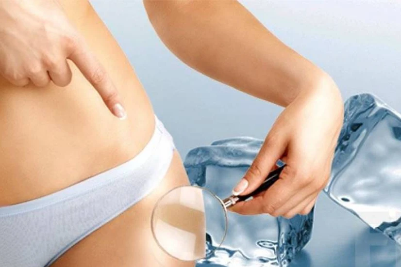 glacon pour la cellulite