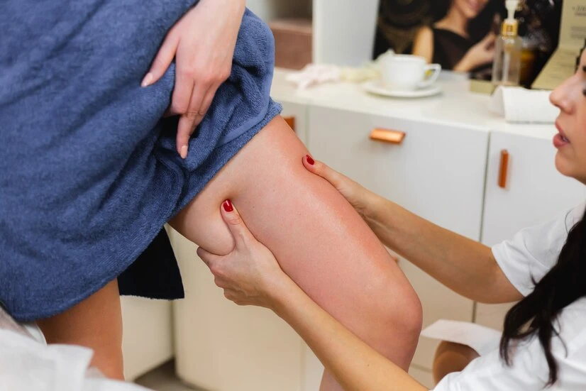 massage anti cellulite