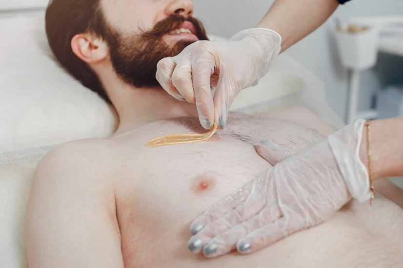 epilation des hommes